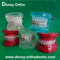 Metal bracket  model Teeth Model Dental