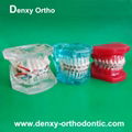 Metal bracket  model Teeth Model Dental model Orthodontic accessory 3