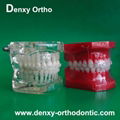 Metal bracket  model Teeth Model Dental model Orthodontic accessory