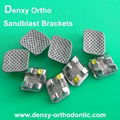 orthodontic brace roth