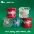 Dental Bracket Orthodontic Bracket Orthodontic braces dental supply