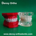 orthodontic model tooth model orthodontic braces teeth model