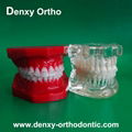 orthodontic model tooth model orthodontic braces teeth model 2