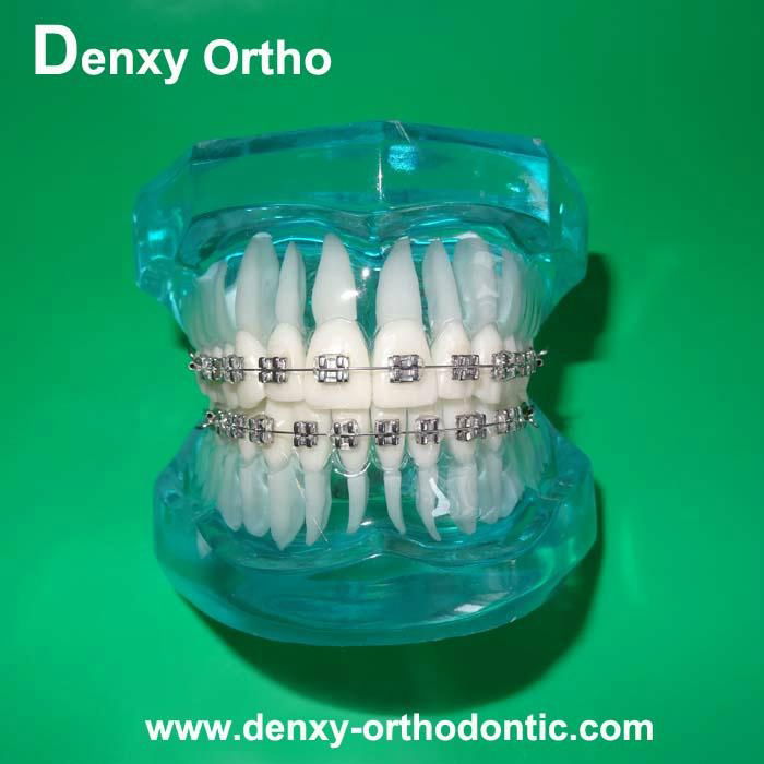 orthodontic model tooth model orthodontic braces teeth model 4