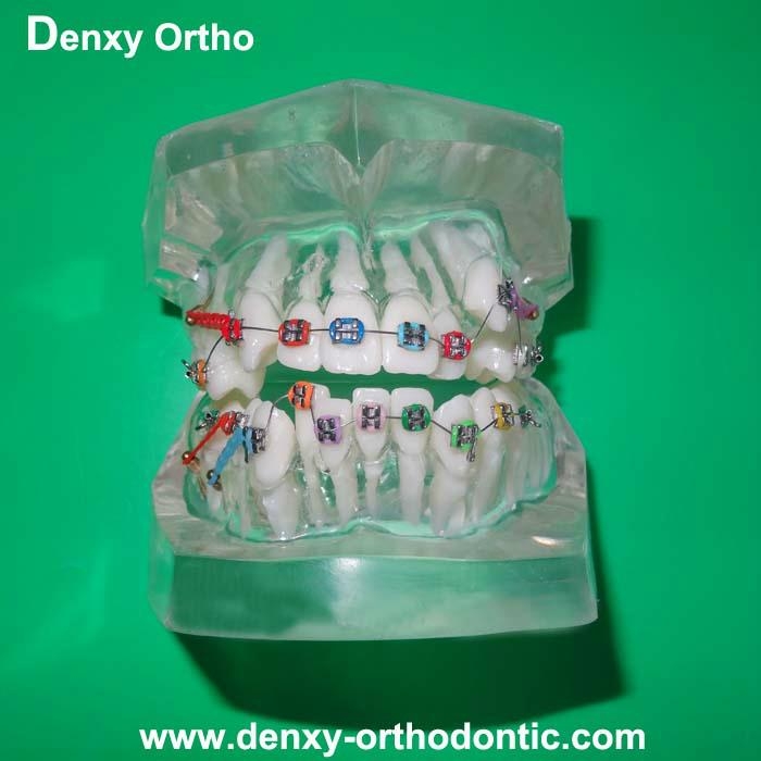 orthodontic model tooth model orthodontic braces teeth model 5