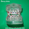 orthodontic model tooth model orthodontic braces teeth model