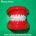 orthodontic model tooth model orthodontic braces teeth model 6