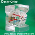 orthodontic model tooth model orthodontic braces teeth model