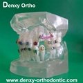Metal bracket  model Teeth Model Dental model Orthodontic accessory
