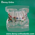 Metal bracket  model Teeth Model Dental model Orthodontic accessory