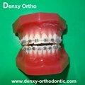 Metal bracket  model Teeth Model Dental model Orthodontic accessory 15