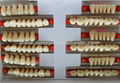 Denxy synthetic resin teeth posteriors resin teeth