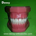 dental teeth red color