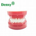 Metal self ligating bracket dental self