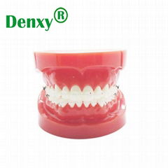 Metal self ligating bracket dental self ligation brackets