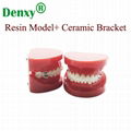 Metal self ligating bracket dental self ligation brackets 2