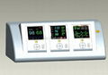 Telemetry ECG 1