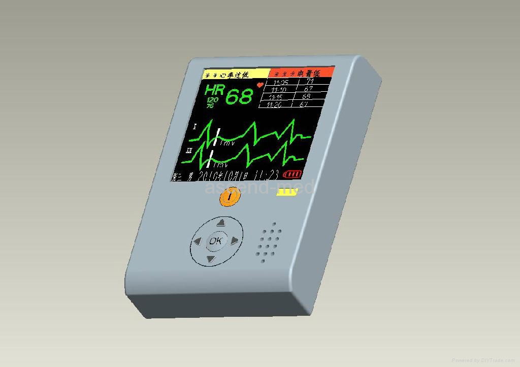 Telemetry ECG 4