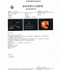 Medical Dry Film(CT-9)  hospital with laser film，