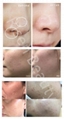 Newest 6 in 1 hydra facial for deep cleaning 6