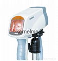 digital video colposcope for gynecology exam colposcopy device(CE approved)