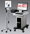 digital video colposcope for gynecology exam colposcopy device(CE approved)