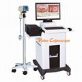 digital video colposcope for gynecology