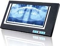 Dental film viewer/ film viewer for dental 