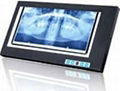 Dental film viewer/ film viewer for dental 