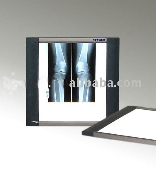 LED Medical x-ray film  illuminator