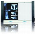 Medical X-ray film viewing box / medical