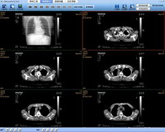 CT/MR/X光机/数字胃肠影像工作站软件 CT工作站 模拟