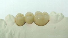 Dental PFM Crown