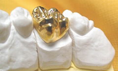 Dental full metal crown