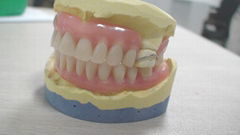 Partial denture