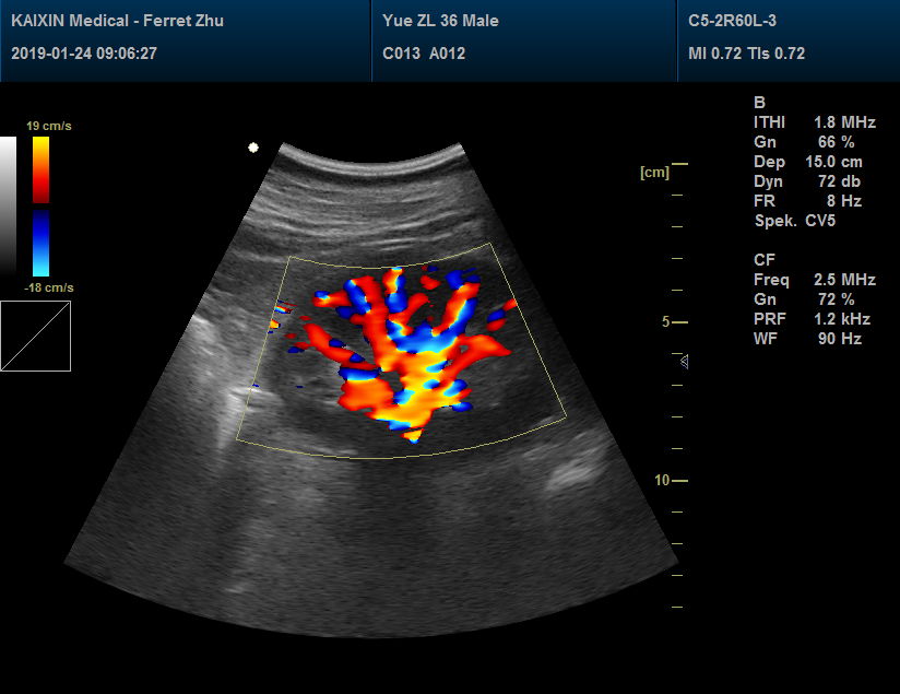 DCU30 Veterinary Color Doppler System 5