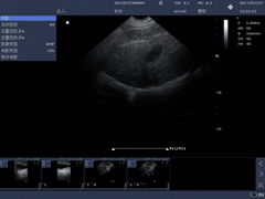 DCU10 Veterinary Color Doppler System