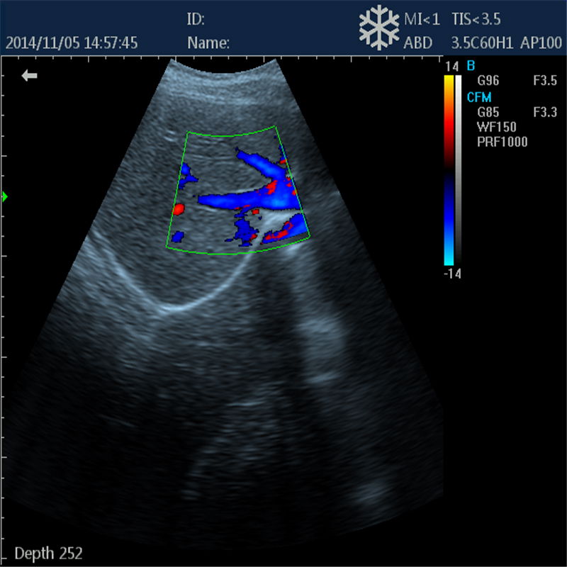 DCU12 Veterinary Color Doppler System 4