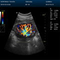 DCU50 Color doppler(Human/vetereinary)  