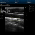 DCU50 Color doppler(Human/vetereinary)   4