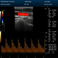 DCU50 Color doppler(Human/vetereinary)   5