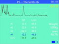 MSU3 Full Digital Mechanical Sector Ultrasound Scanner 4