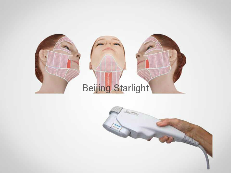 High Intensity Focused Ultrasound (HIFU) for skin lifting and skin tightening 3