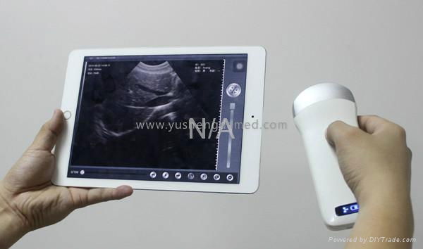 Ultrasound scanner 3