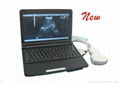 3000 Laptop Full Digital Ultrasound 1