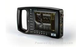palm ultrasound scanner 
