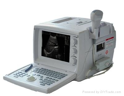 810 Digital Ultrasound Scanner ( 80 element)