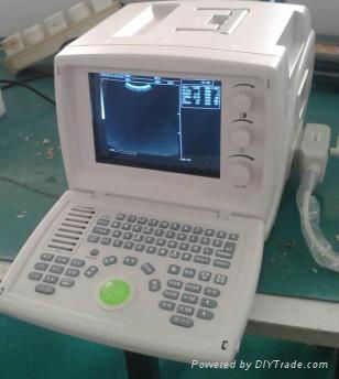 810 Digital Ultrasound Scanner ( 80 element) 2