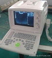 810 Digital Ultrasound Scanner ( 80 element) 2