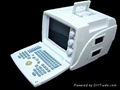 810 Digital Ultrasound Scanner ( 80 element) 3